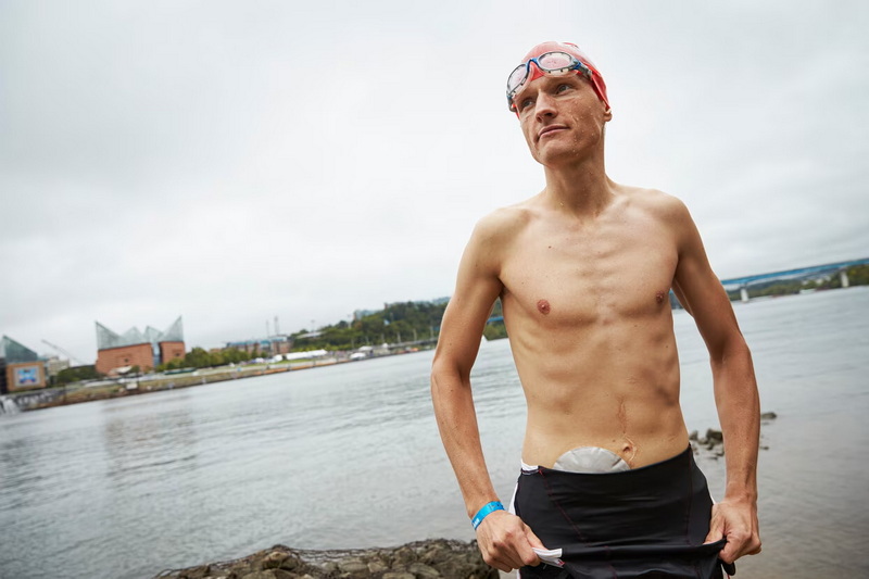 Adaptive Swimwear For Ostomy Users